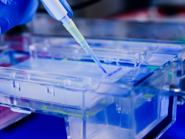 What Should We Consider When Choosing Micropipette?
