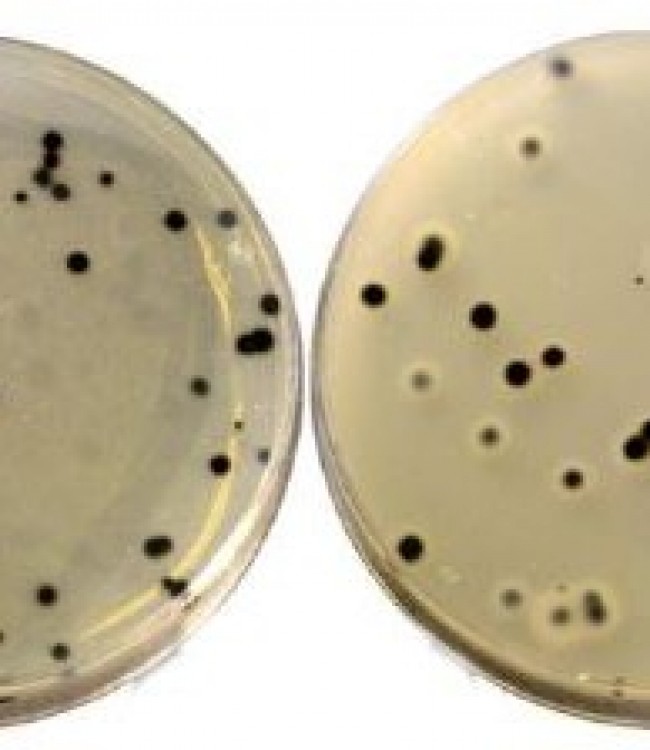 TSC Agar (Clostridium Perfringens)