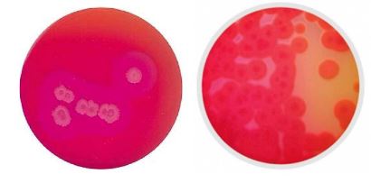 Bacillus Cereus Myp Agar : Agar Base Selectivo Bacillus Cereus (MYP ...